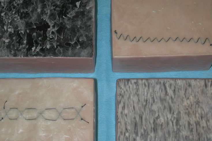 ann schwab | tissue sample